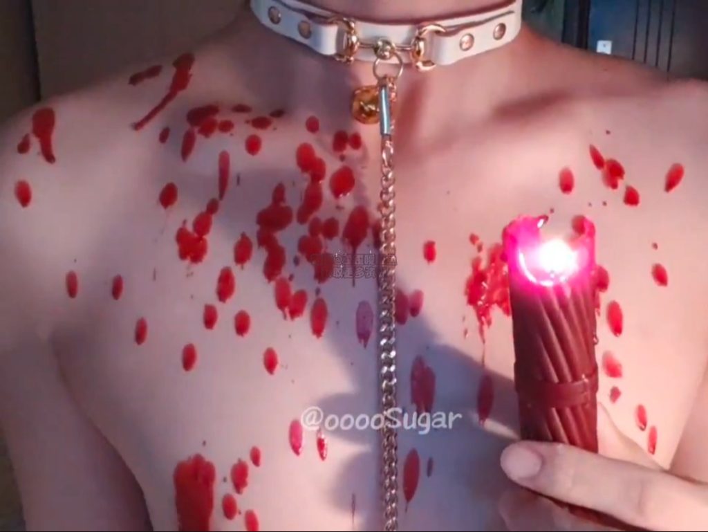 乳糖超不耐合集